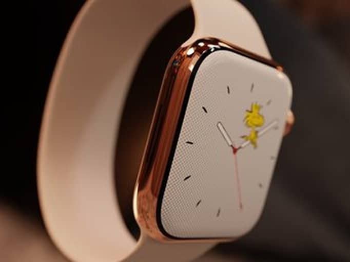 Apple Watch Series 11 – Gold Edition